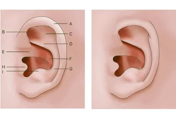 rhinoplastie non chirurgicale otoplastie oreilles decollees chirurgien esthetique paris dc federico loreto centre de medecine esthetique paris