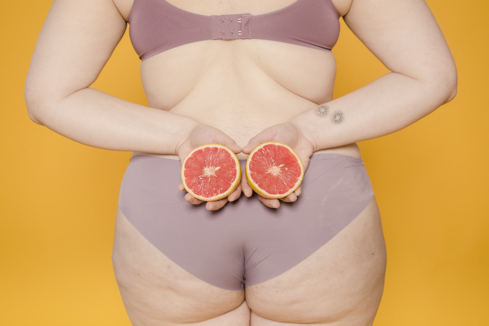 Image illustrant les causes de la cellulite, incluant l'accumulation de graisse, des facteurs génétiques et des déséquilibres hormonaux.