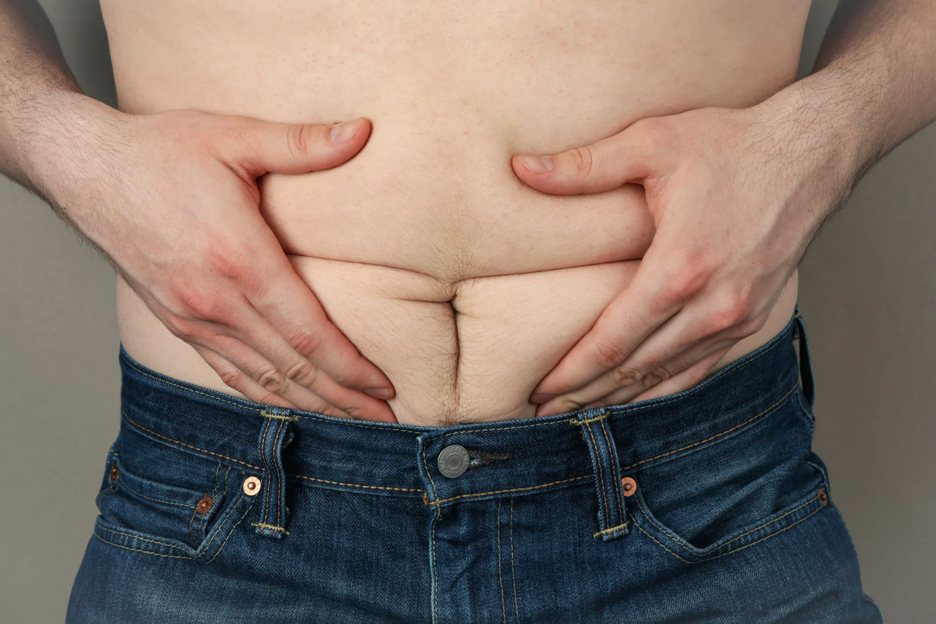Photo illustrant les facteurs de risque de cellulite chez l'homme, y compris l'obésité, le tabagisme et l'inactivité physique.